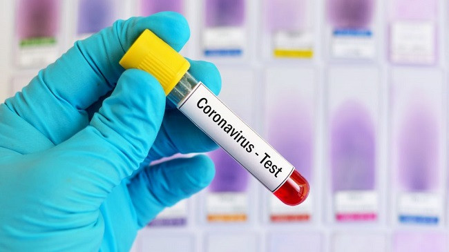 Komiteti për Sëmundje ngjitëse në Kosovë ka përgatitur planin e reagimit për koronavirus