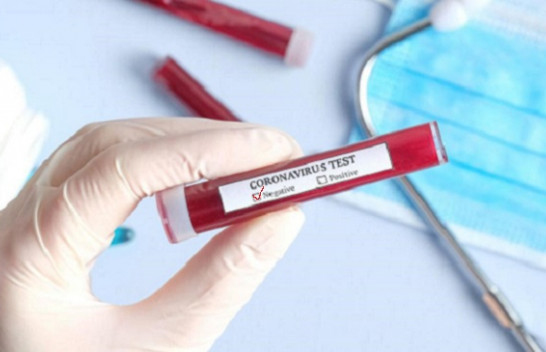 Dyshime për dy pacientë me koronavirus, por ata rezultuan negativë, Kosova e paprekur nga ky virus