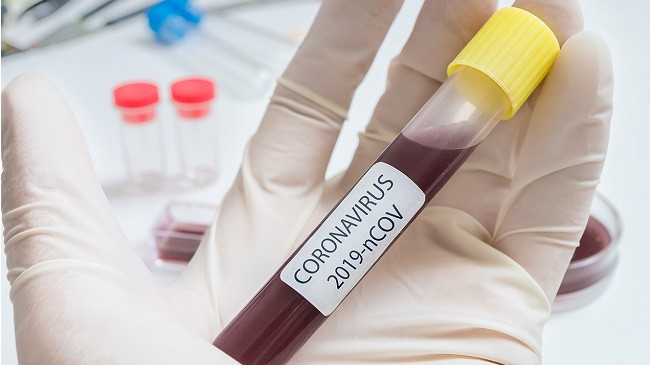 Instituti i Shëndetësisë Publike: Në Kosovë nuk ka koronavirus