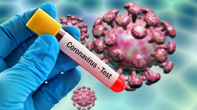 Shkon në 7 numri i të prekurve me koronavirus në Maqedoninë e Veriut