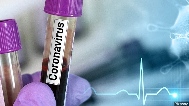 IKSHPK: Rezultatet laboratorike konfirmojnë se në Kosovë s’ka koronavirus