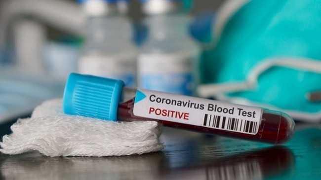 Thyhet ‘miti’ konfirmohen dy raste me koronavirus në Kosovë