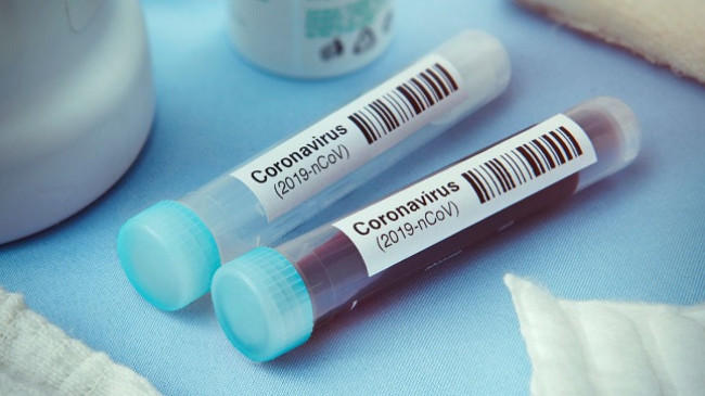 Konfirmohen edhe dy raste të reja me koronavirus në Kosovë