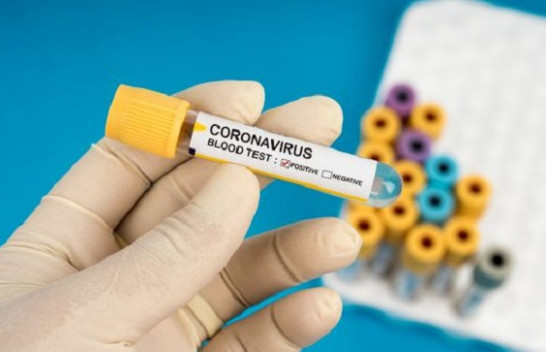Shënohet edhe një rast me koronavirus në Kosovë, arrin në 21 numri i të prekurve