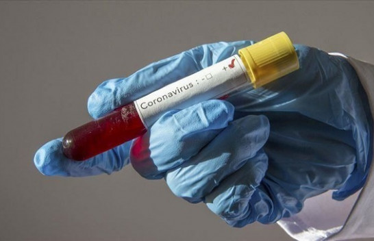 Shënohen edhe 12 raste me koronavirus, shkon në 106 numri i të prekurve në Kosovë