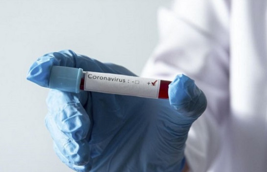 Regjistrohen edhe 13 raste të reja me koronavirus, shkon në 125 numri i të infektuarve në Kosovë