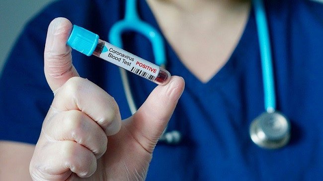 Shkon në 145 numri i të infektuarve me koronavirus në Kosovë