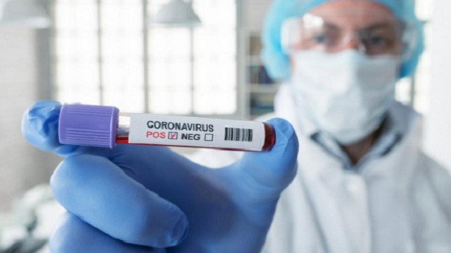 Rritet bilanci/ 51 raste të reja me koronavirus – shkon në 561 numri i të prekurve në Kosovë