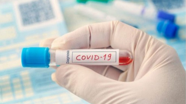 Tre të shëruar dhe 14 raste të reja me koronavirus në Kosovë