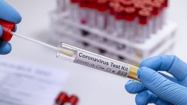 Shtatë të shëruar dhe një rast i ri me koronavirus në Kosovë