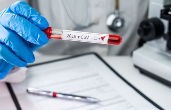 IKSHPK: 19 raste të reja me koronavirus dhe 24 të shëruar në Kosovë