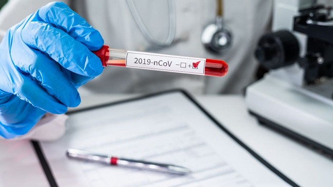 IKSHPK: 19 raste të reja me koronavirus dhe 24 të shëruar në Kosovë