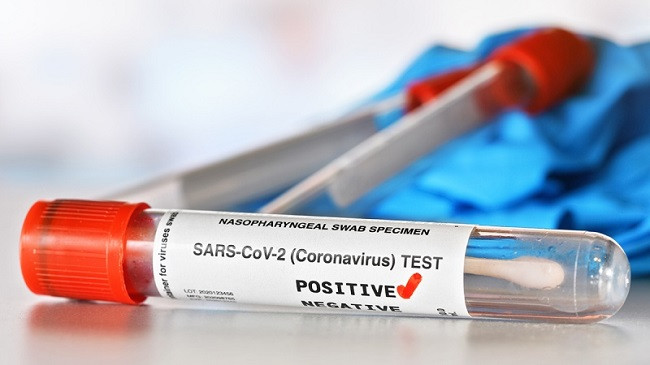 Pesë raste të reja me koronavirus dhe tre të shëruar në Kosovë