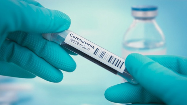 Edhe 28 raste të reja me koronavirus dhe tetë të shëruar në Kosovë