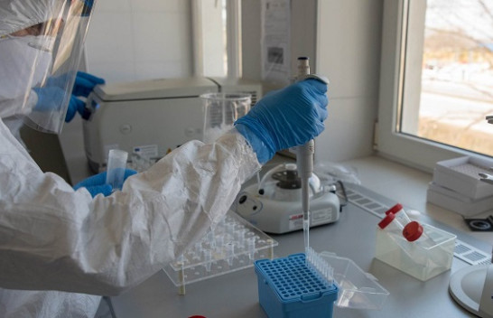 Konfirmohen 134 të infektuar me koronavirus në Maqedoninë e Veriut