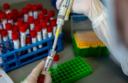 Konfirmohen edhe 83 raste me koronavirus dhe pesë të shëruar në Kosovë
