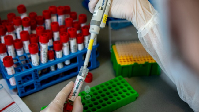 Konfirmohen edhe 83 raste me koronavirus dhe pesë të shëruar në Kosovë