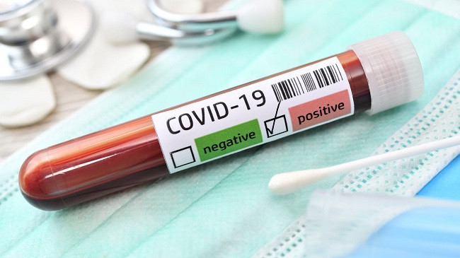 82 raste të reja me koronavirus dhe shtatë të shëruar në Kosovë