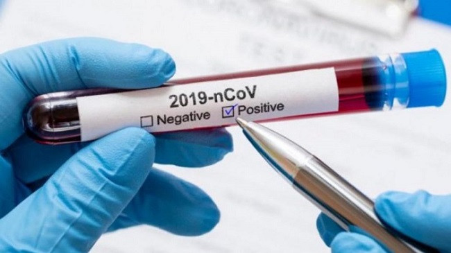 52 raste të reja me koronavirus dhe 39 të shëruar në Kosovë