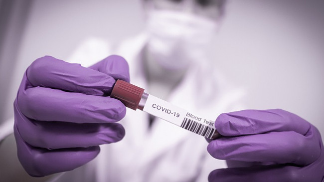 61 të shëruar dhe 62 raste të reja me koronavirus në Kosovë