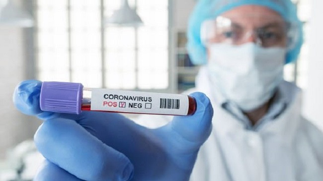 73 raste të reja me koronavirus në Kosovë