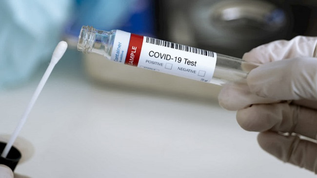 Konfirmohen 187 raste të reja dhe 103 të shëruar nga koronavirusi në Kosovë
