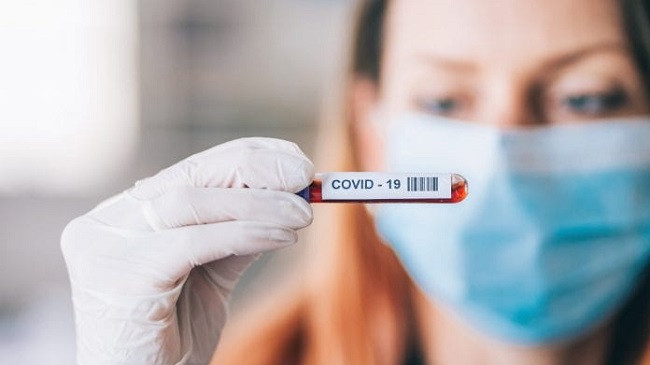 Instituti i Shëndetësisë: 168 raste të reja dhe 157 të shëruar nga koronavirusi në Kosovë