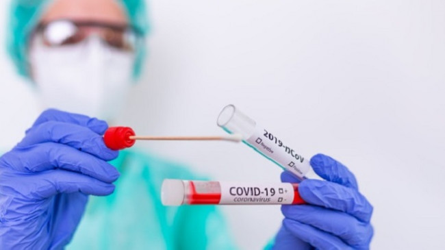 Sot 181 raste të reja dhe 136 të shëruar nga koronavirusi në Kosovë