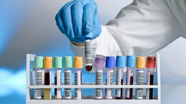 Ministria e Shëndetësisë publikon listën e laboratorëve privatë që do të kryejnë teste serologjike dhe molekulare për COVID-19
