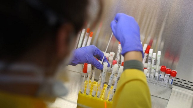 Licencohen edhe 10 laboratorë privatë për kryerjen e testeve për COVID-19