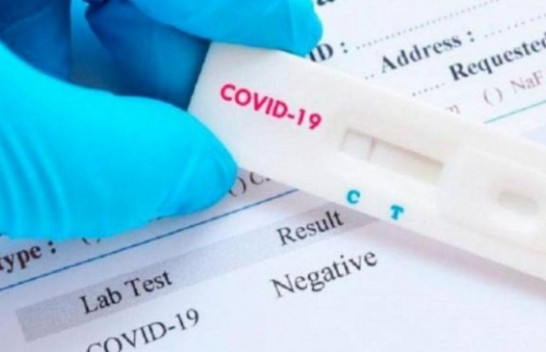 Për 24 orë, 169 raste të reja dhe 85 të shëruar me koronavirus në Kosovë