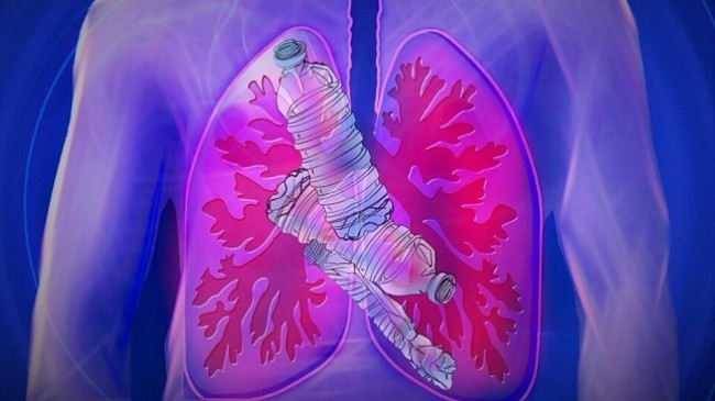 Grimcat plastike zbulohen për herë të parë thellë në mushkëritë e njeriut