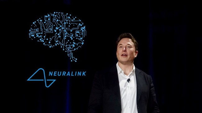 Neuralink i Elon Musk thotë se ka miratimin e FDA për studimin e implanteve të trurit tek njerëzit