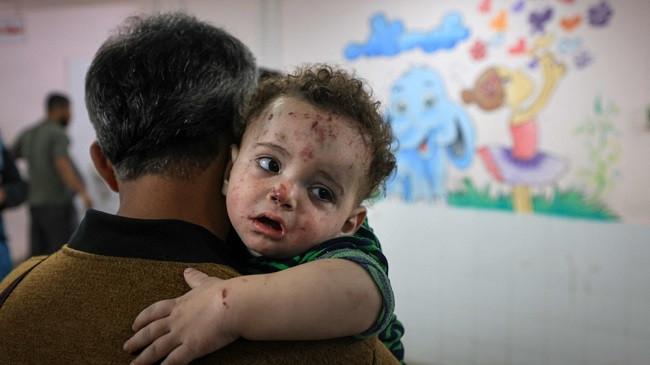 Infermierja e Mjekëve pa Kufij përshkruan tmerret që ajo ka parë në Gaza