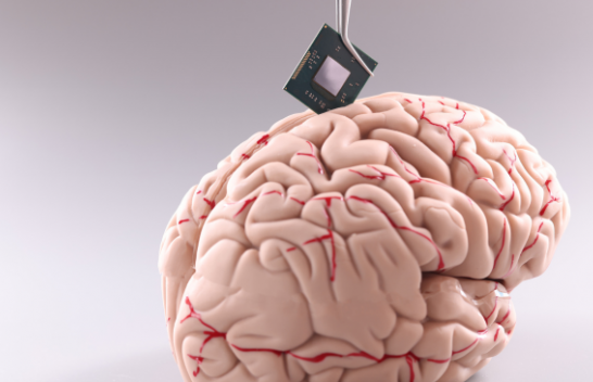 Implantohet çipi i parë në trurin e njeriut, ja kush e realizoi