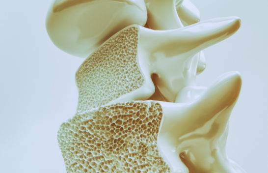 Zbulimi i madh shkencor që një ditë mund ta përmbysë osteoporozën